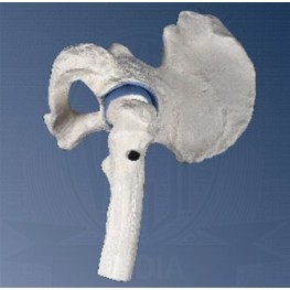 VKSI Mini Hip Joint with Cross-Section