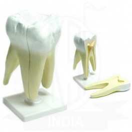 VKSI Human Tooth Model