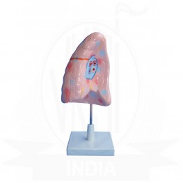 VKSI Human Lungs Model