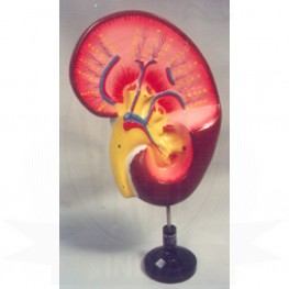VKSI Human Kidney Model