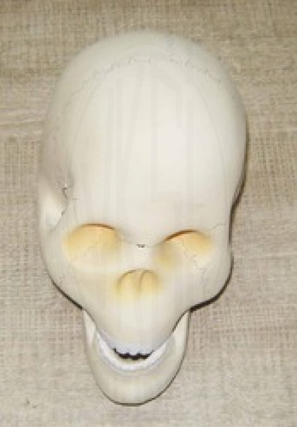 VKSI Human Skull Model