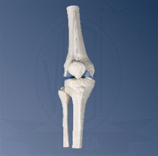 VKSI Mini Knee Joint with Cross-Section