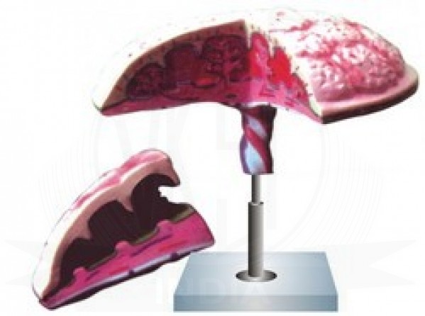VKSI Human Placenta